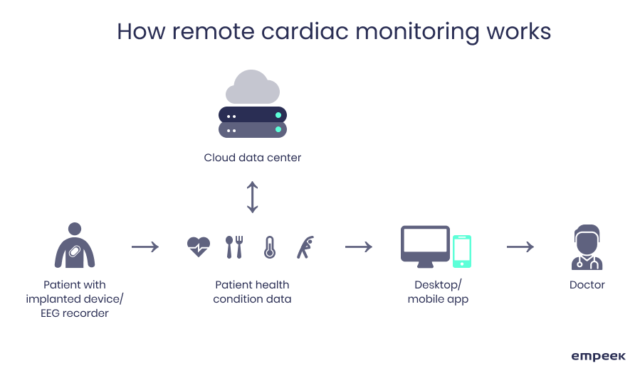 How remote cardiac monitoring works