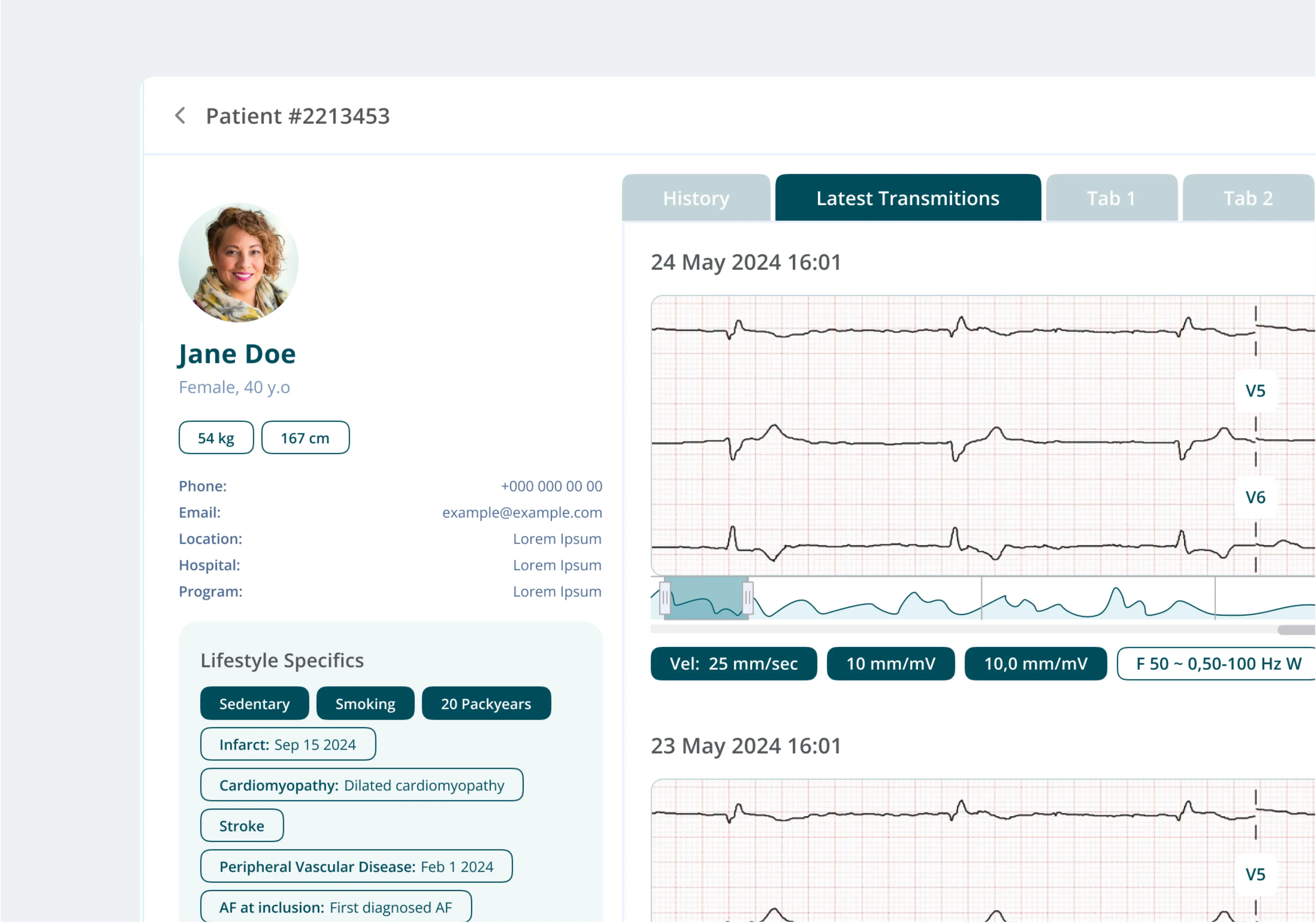 Overview of Health Monitoring Devices and Health Wearables Technology 1