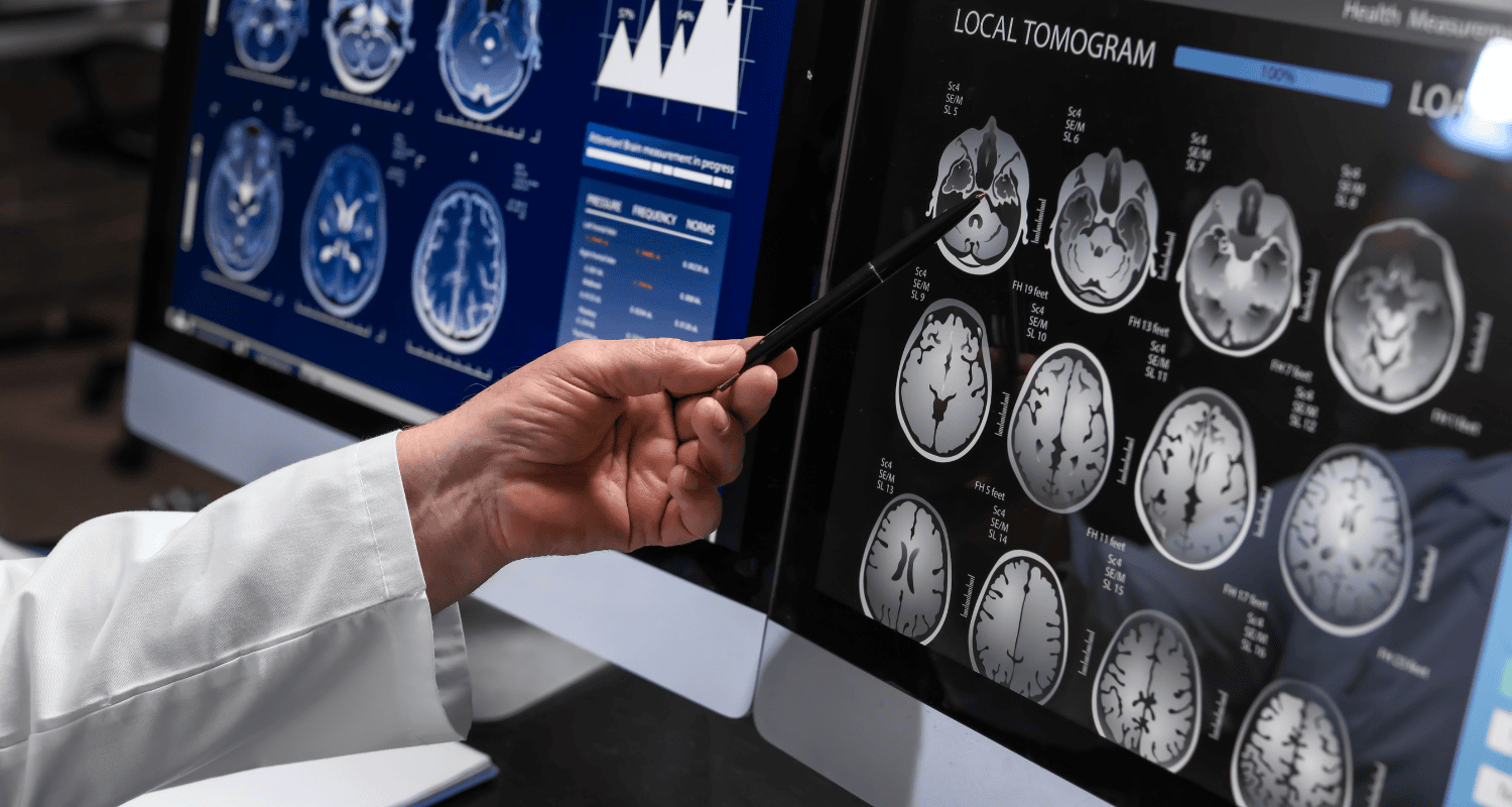 Telemedicine Neurology Overview – Use Cases and Efficiency Research